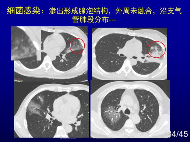 北京新冠肺炎動(dòng)態(tài)更新及應(yīng)對(duì)策略